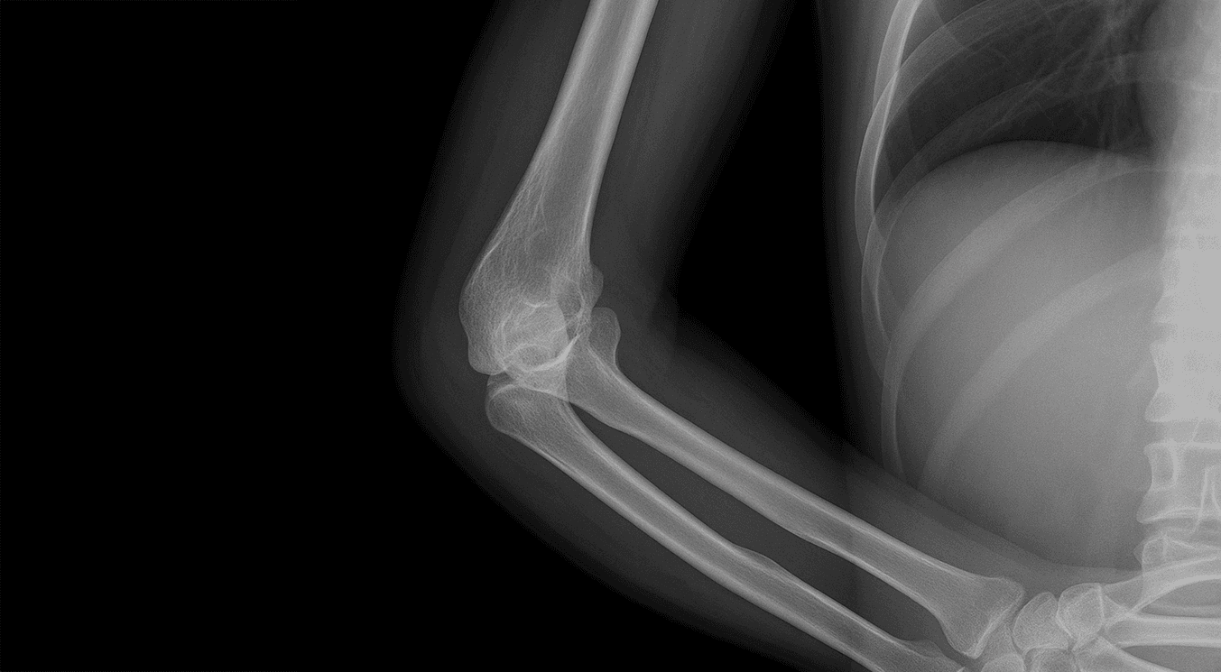 24. De beste 1ste honkman van DSS